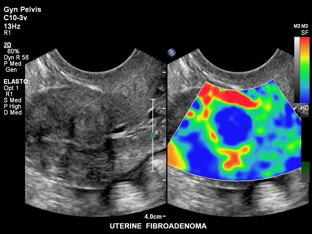 Gallery Item 3